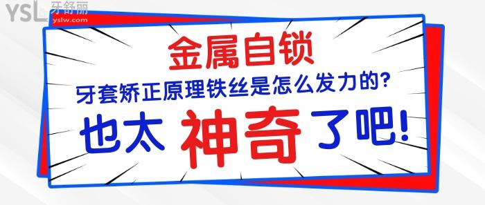 金屬自鎖牙套矯正原理鐵絲是怎么發(fā)力的