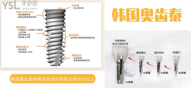 韓國奧齒泰種植體