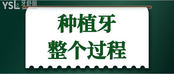 種植牙需要多長時間及多少次才能種植完成.jpg
