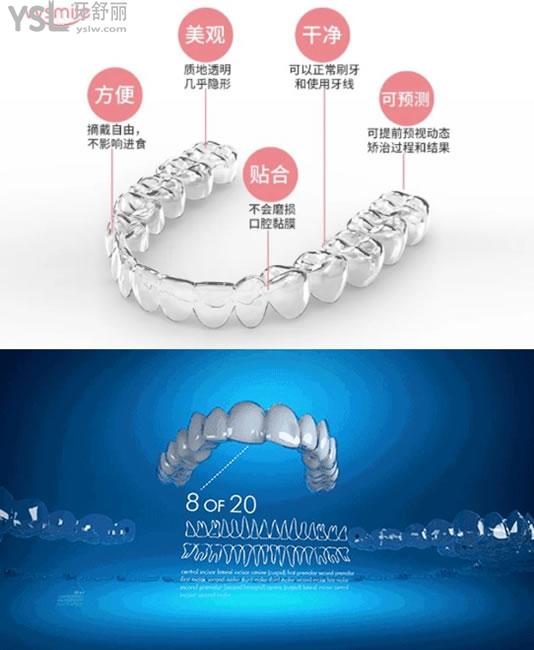 vvsmile隱形牙套