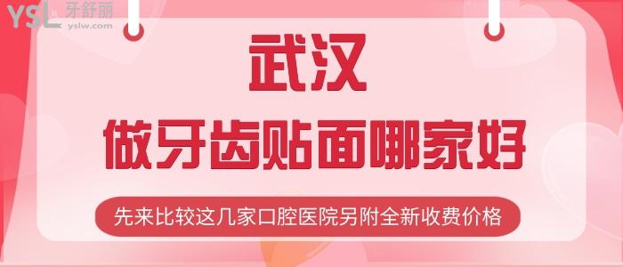 武漢做牙齒貼面哪家好？先來比較這幾家口腔醫(yī)院另附全新收費價格