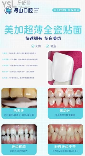 深圳世紀(jì)河山口腔牙貼面優(yōu)勢(shì)