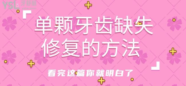 單顆牙齒缺失修復的方法，看完這篇你就明白了