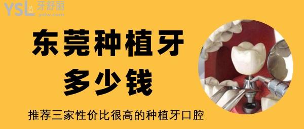 東莞種植牙多少錢 東莞性價(jià)比高的口腔