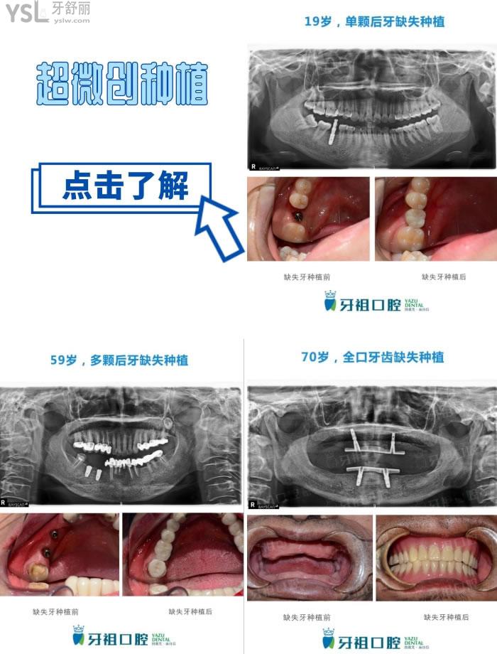 長沙口腔醫(yī)院哪家好