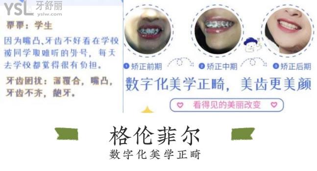 深圳格倫菲爾口腔好評(píng)多嗎