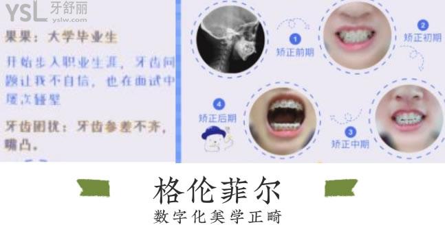 深圳格倫菲爾口腔好評(píng)多嗎