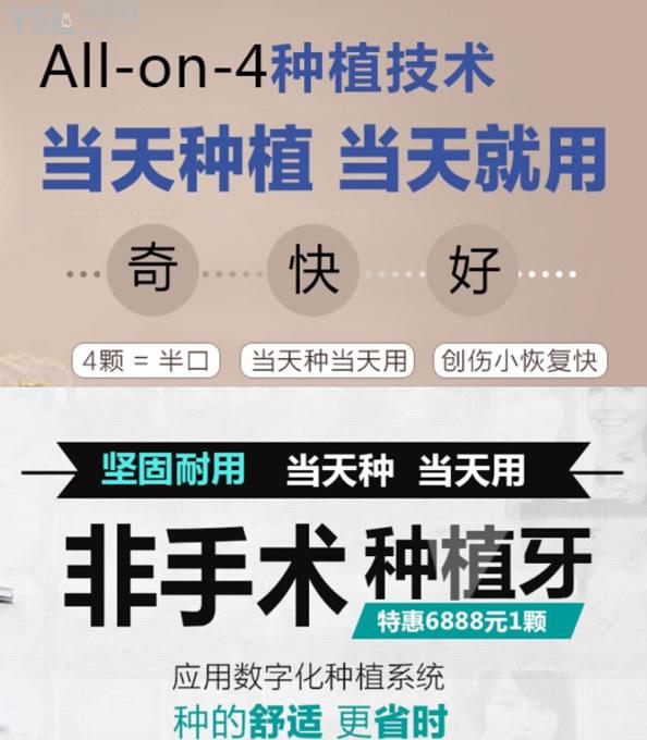 傳陽口腔種植技術