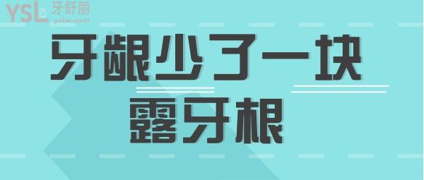 牙齦少了塊肉
