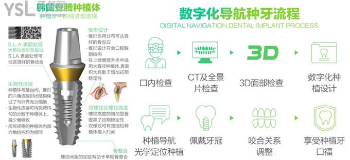 無錫維樂口腔種植牙技術(shù)