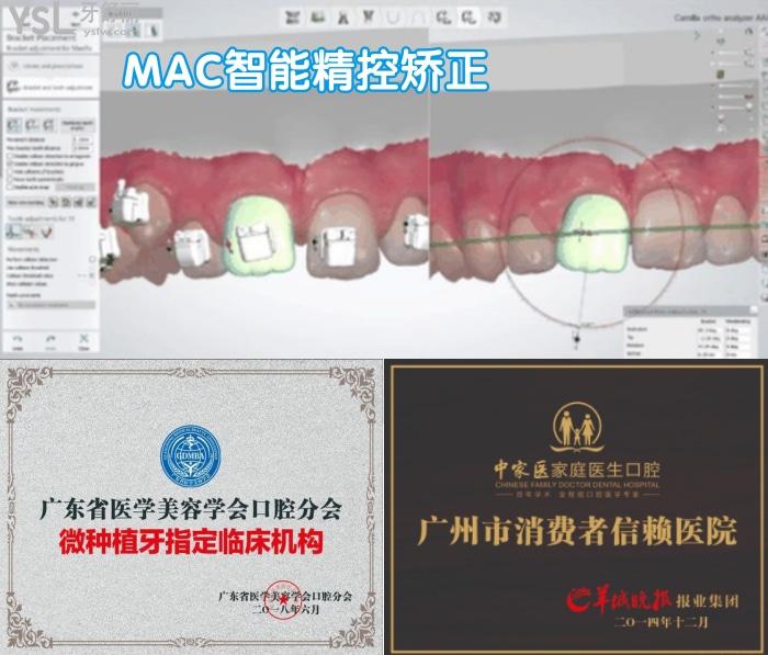 廣州中家醫(yī)家庭醫(yī)生口腔做隱型矯正嗎？多少錢？哪個醫(yī)生好？