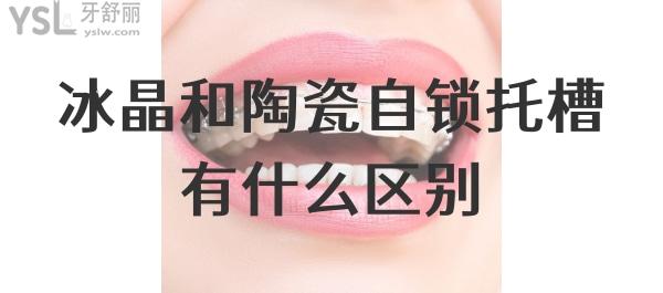 冰晶和陶瓷自鎖區(qū)別