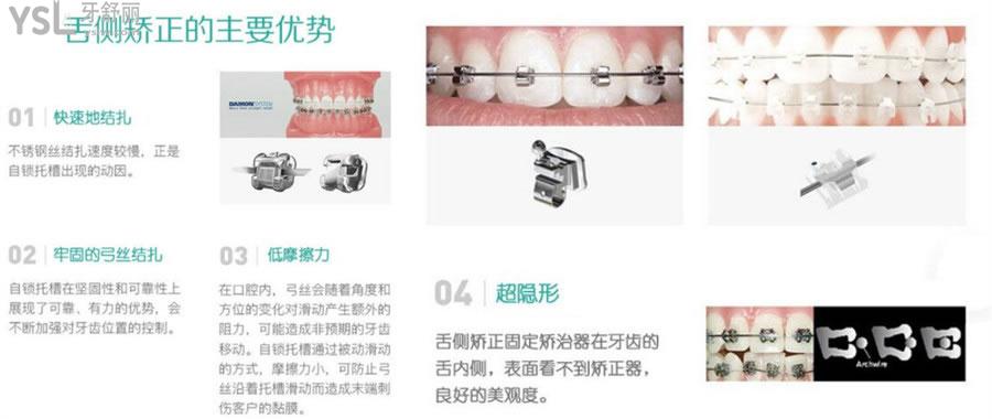 西安畫美團圓口腔醫(yī)院價目表