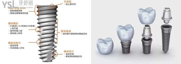 深圳龍華區(qū)種植牙好的牙科推薦.jpg