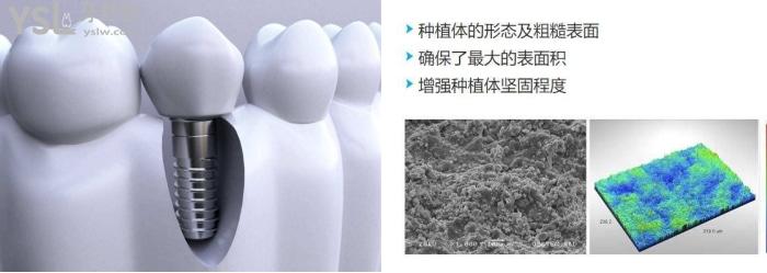 深圳龍華區(qū)種植牙好的牙科推薦.jpg