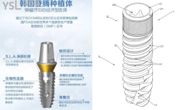 深圳龍華區(qū)種植牙好的牙科推薦.jpg