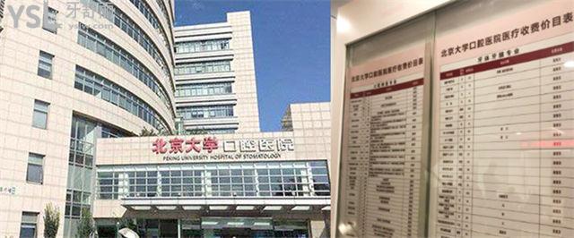 北**腔醫(yī)院價(jià)格表 北京正畸種植牙多少錢