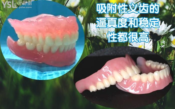 bps全口吸附性義齒價(jià)格多少錢？與普通活動(dòng)義齒的區(qū)別大嗎？
