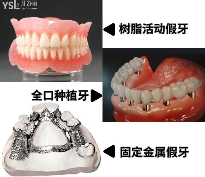 老人做全口假牙托是樹脂的好還是金屬好？做一口假牙多少錢？