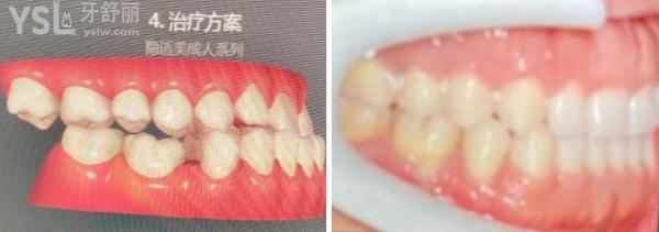 北京中諾口腔醫(yī)院怎么樣.jpg
