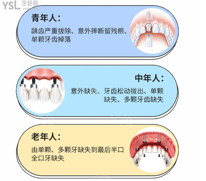 想知道在?？诜N全口牙需要多少錢？看完這份?？谘揽剖召M(fèi)價(jià)目表輕松了解！