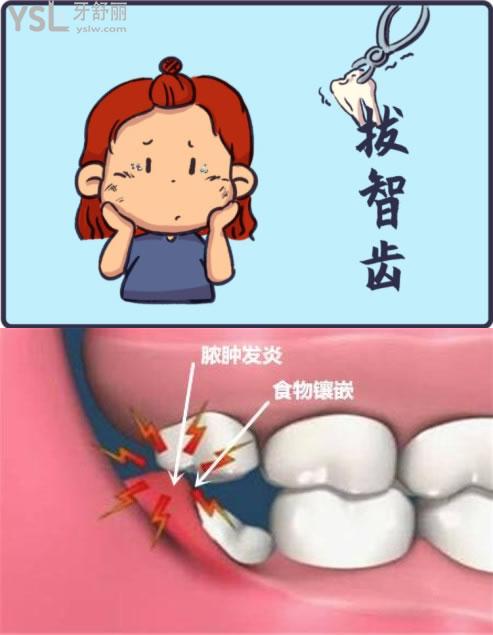 拔智齒圖
