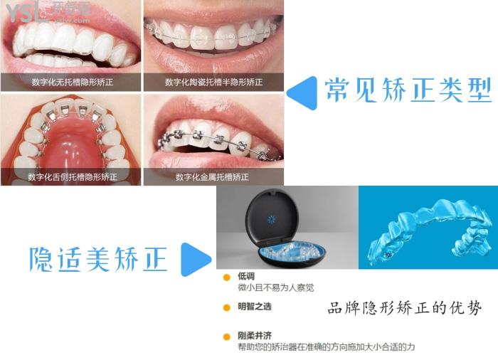 廣州好大夫口腔隱適美矯正怎么樣？技術(shù)靠譜性價(jià)比高就找好大夫！