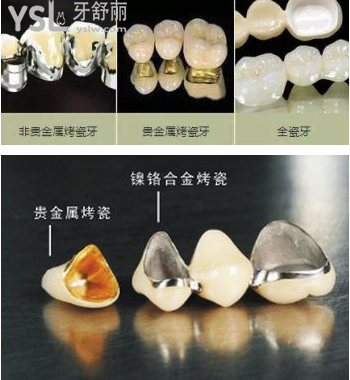 2022北京牙科收費(fèi)價(jià)目