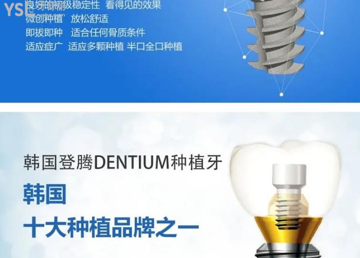 包頭義隆口腔種一顆牙多少錢