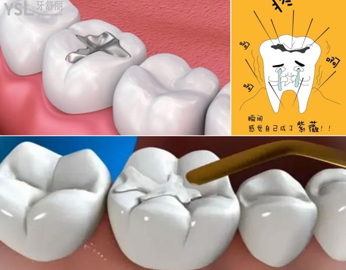 福清哪里補牙比較好.jpg