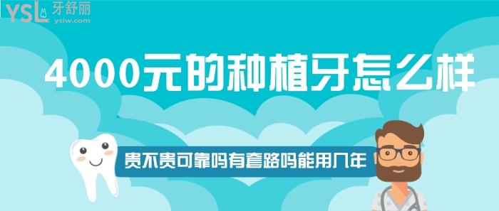 4000元的種植牙怎么樣.jpg