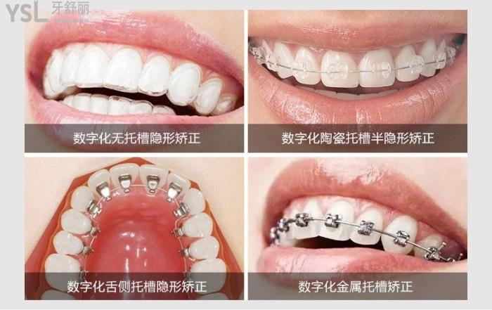 常州哪家口腔醫(yī)院正畸好？推薦技術(shù)好的美奧/魏東口腔技術(shù)好價格不貴