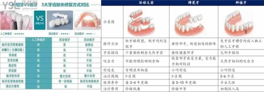 福州做全口假牙多少錢
