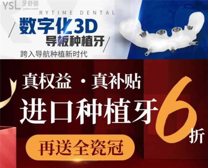 青島種植牙排名前五