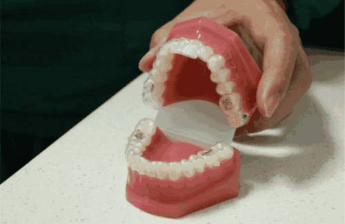 贛州衛(wèi)華口腔.gif