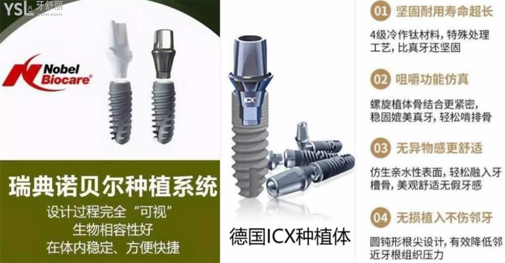 是德國icx還是瑞士iti還是瑞典諾貝爾種植牙好