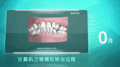 宜賓箍牙價格