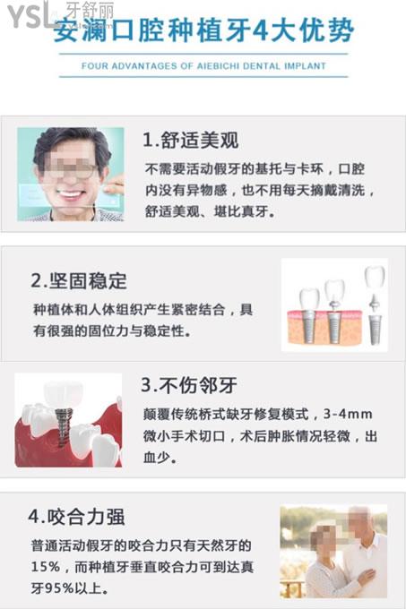 常熟安瀾口腔種植牙優(yōu)勢(shì)