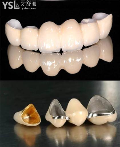 包頭牙科收費(fèi)價(jià)目表