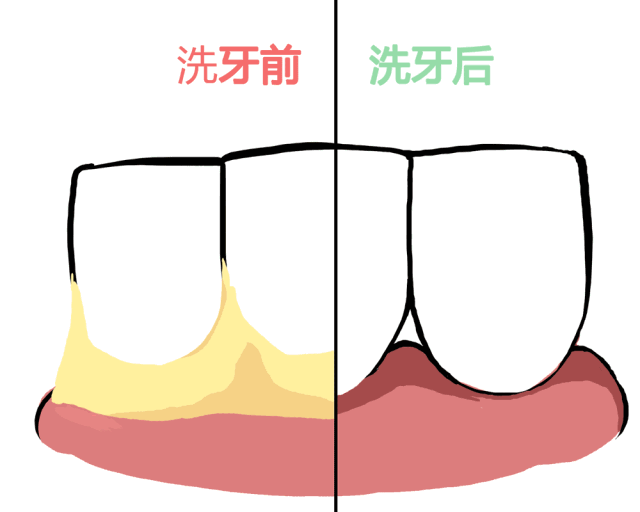 天津牙科收費(fèi)價(jià)目表