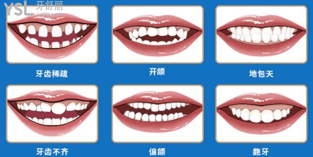 東莞口腔醫(yī)院**活動