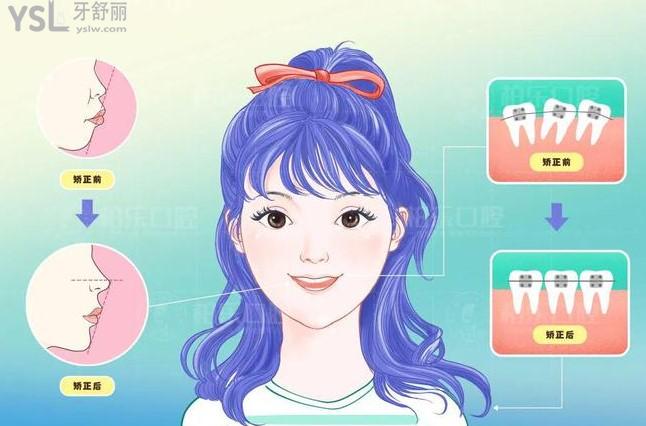 牙齒矯正