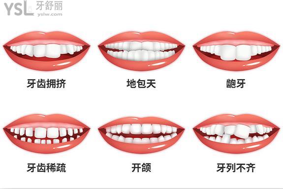 哪些情況需要牙齒矯正呢