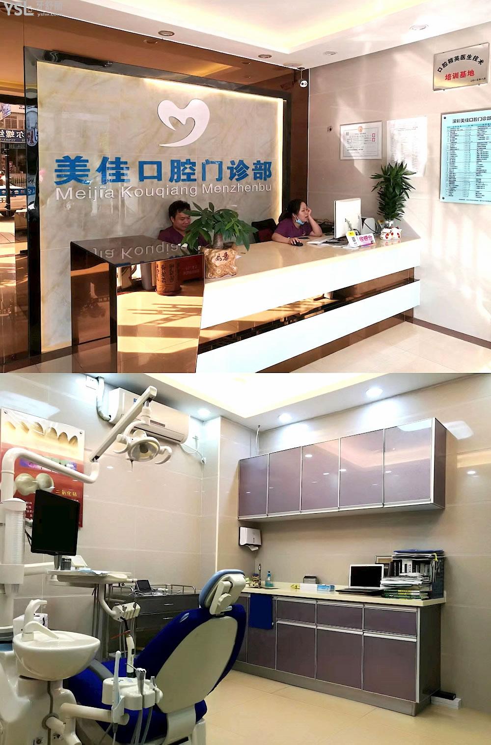深圳美佳口腔門診部怎么樣制定收費標(biāo)準(zhǔn)的,牙齒矯正/種植牙價目表公示好還劃算!