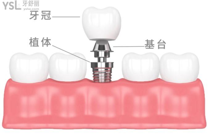 重慶美奧口腔6月活動(dòng)