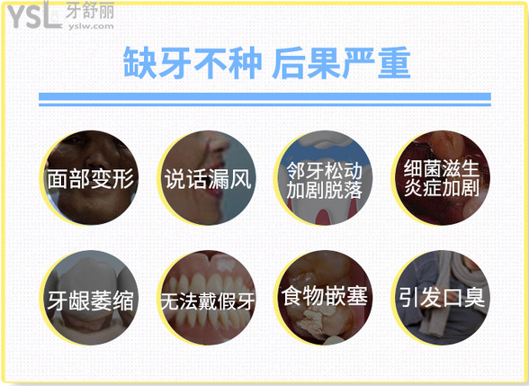 缺牙不補(bǔ)的話(huà)引發(fā)后果