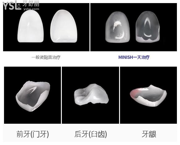韓國(guó)今日安minish牙科