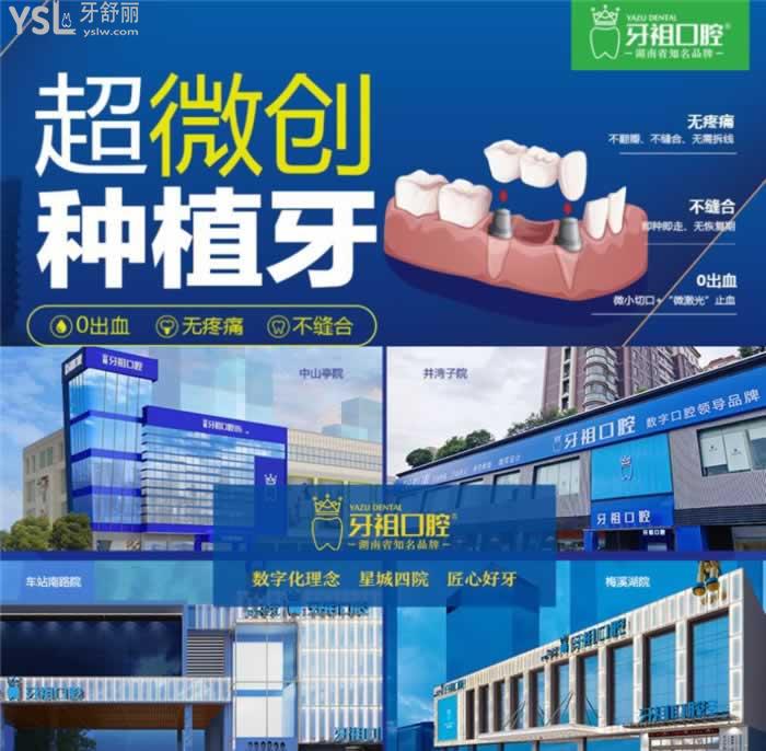 長沙哪里種植牙便宜