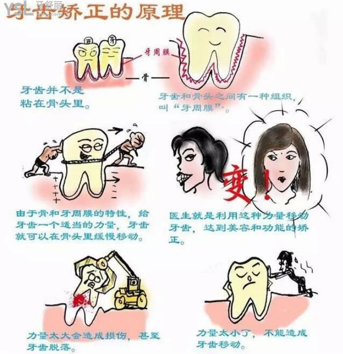 西安隱形牙套費(fèi)用大概多少
