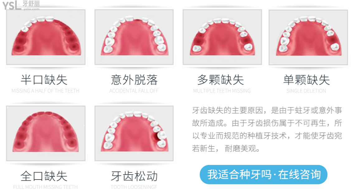 哪些情況需要做種植牙